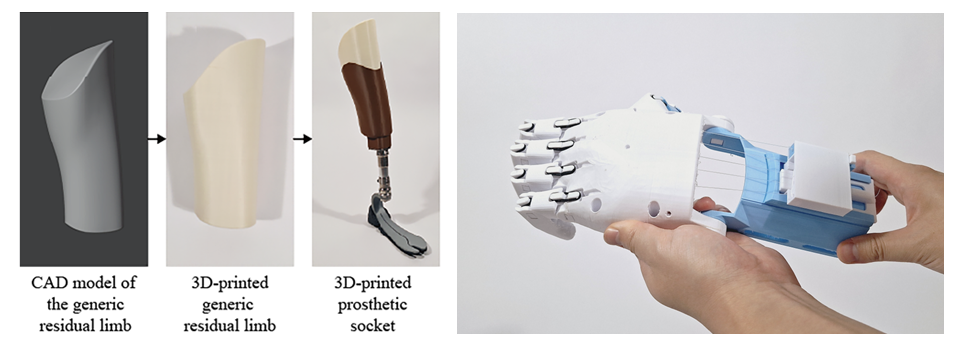 Accessible 3D-Printed Prosthetics